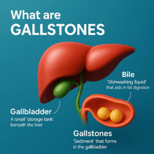 ถ่อยอภาพของตับและถุงน้ำดี พร้อมคำอธิบายเกี่ยวกับนิยามของก้อนนิ่วในถุงน้ำดีและส่วนประกอบต่าง ๆ ของระบบทางเดินอาหารชาย.